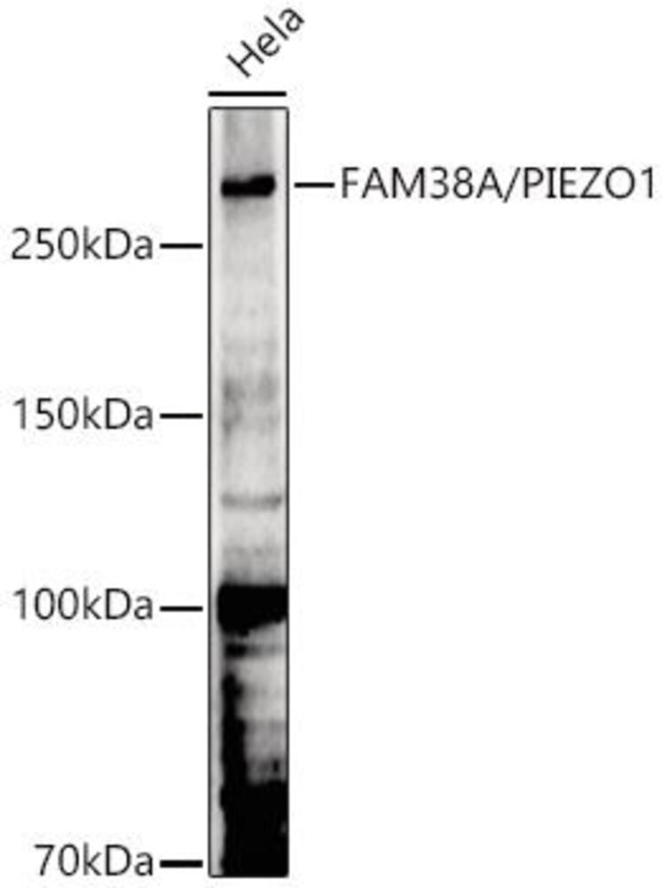 Anti-FAM38A / PIEZO1 Antibody, 100 µl - Luminix Health