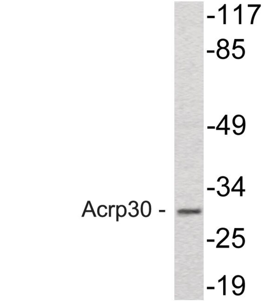 Anti-Acrp30 Antibody, 100 µg - Luminix Health