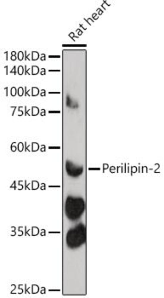 Anti-ADFP Antibody, 100 µl - Luminix Health