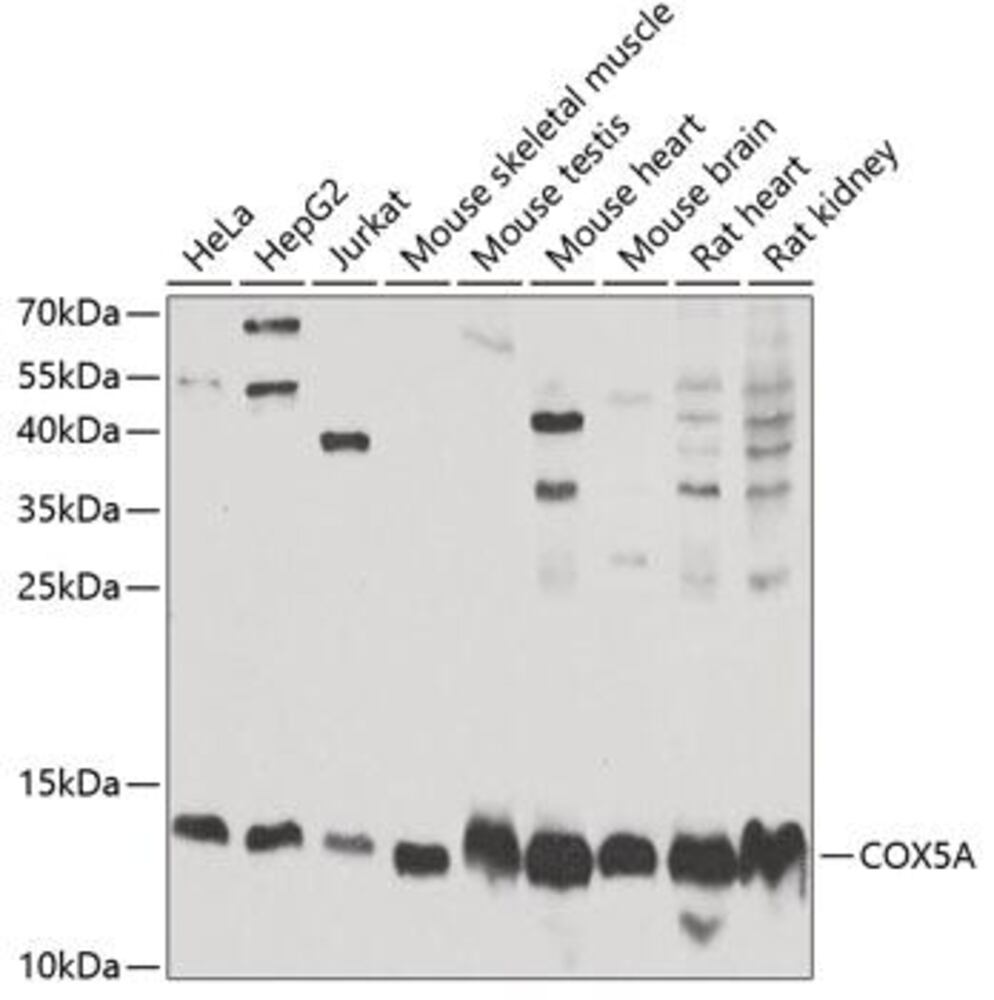 Anti-COX5A Antibody, 100 µl - Luminix Health