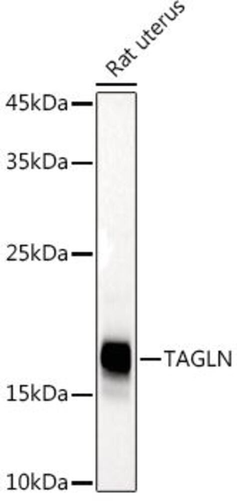 Anti-TAGLN / Transgelin Antibody, 100 µl - Luminix Health