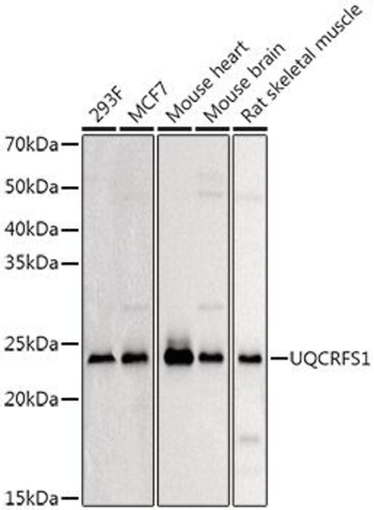 Anti-UQCRFS1 / RISP Antibody, 100 µl - Luminix Health