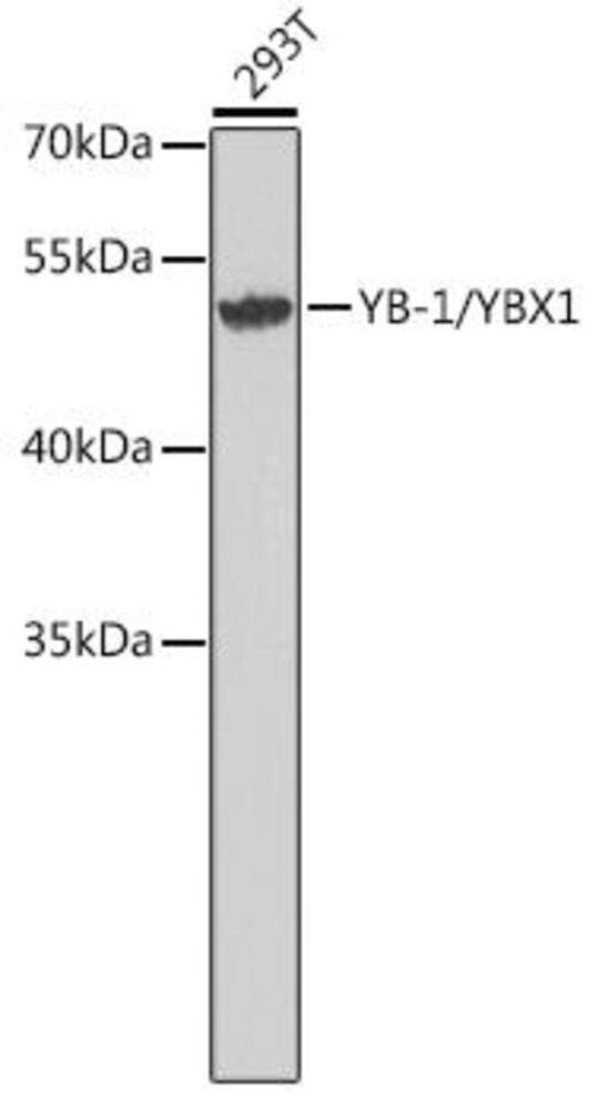 Anti-YB1 Antibody, 100 µl - Luminix Health