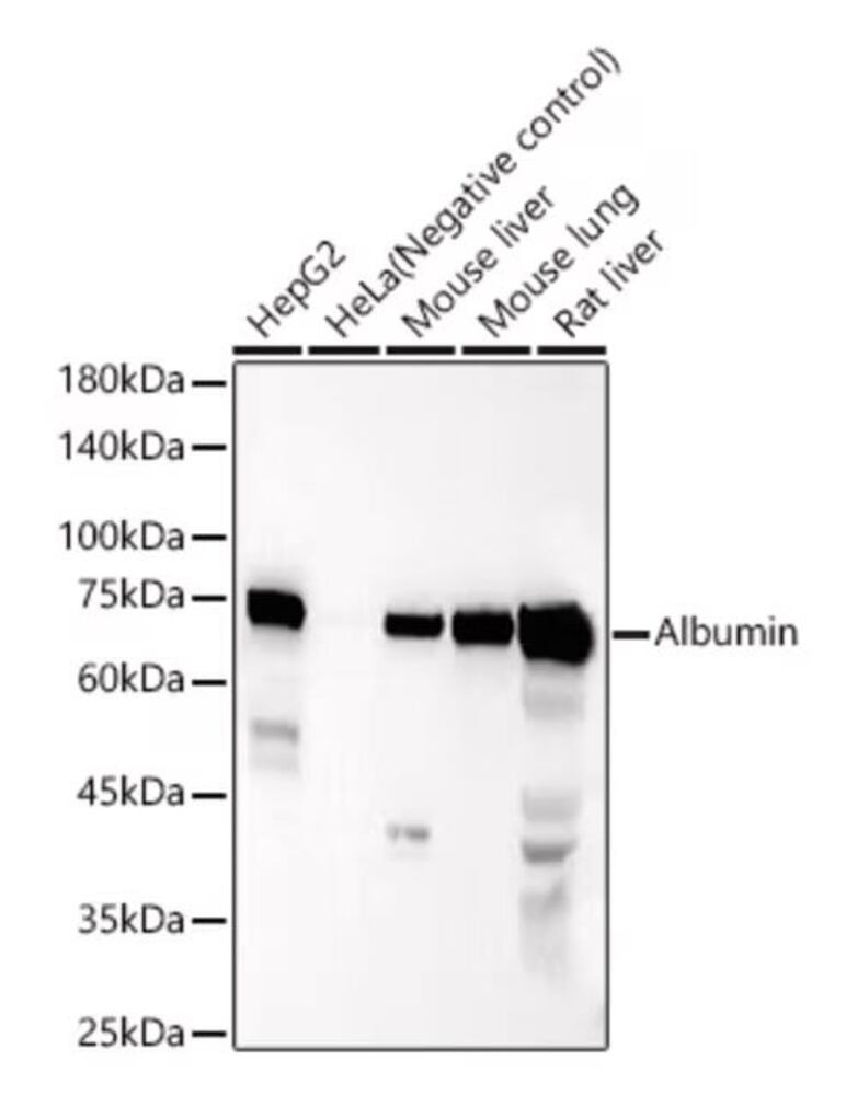 Ezel anti-geit IgG H&amp;L antilichaam (HRP)