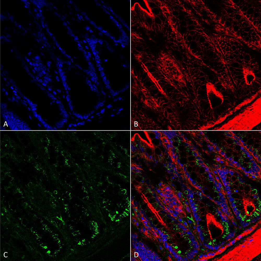 Anti-O-GalNAC Antibody [9B9], 100 µg