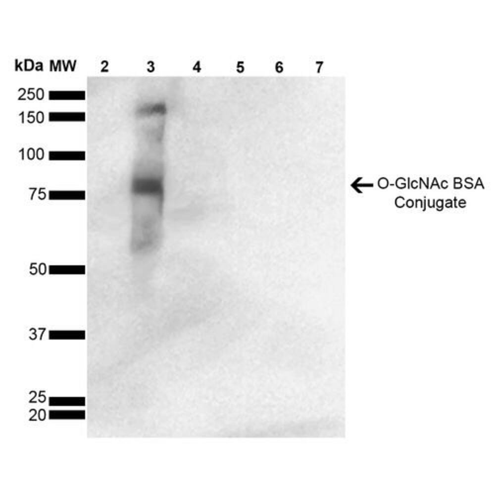 Anti-O-GalNAC Antibody [9H6]