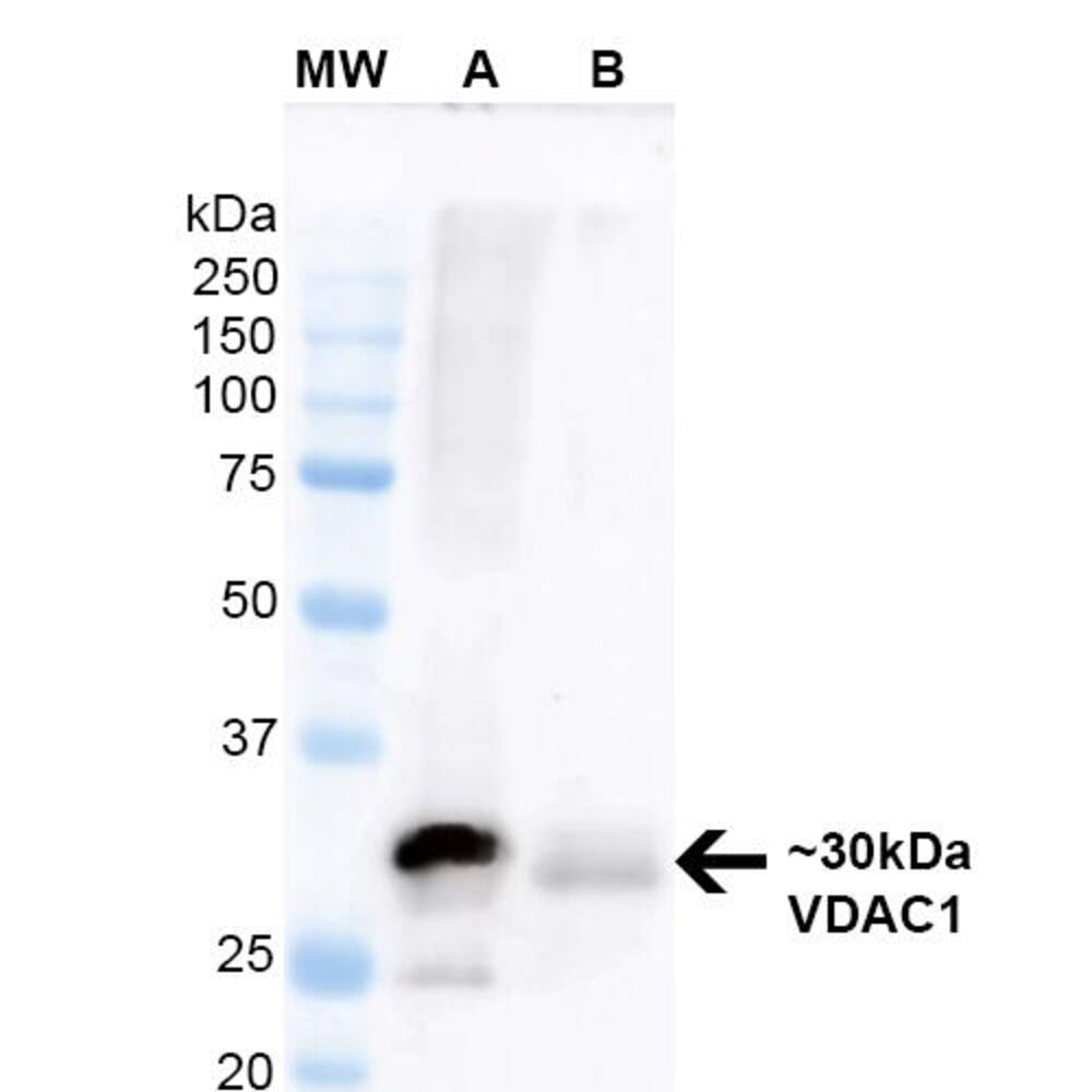 Anti-VDAC1 / Porin Antibody [S152B-23]
