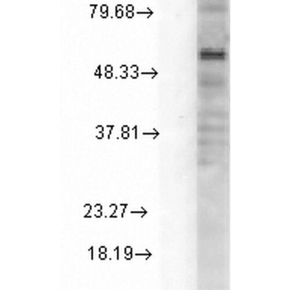 Anti-GABRD Antibody [N151/3]