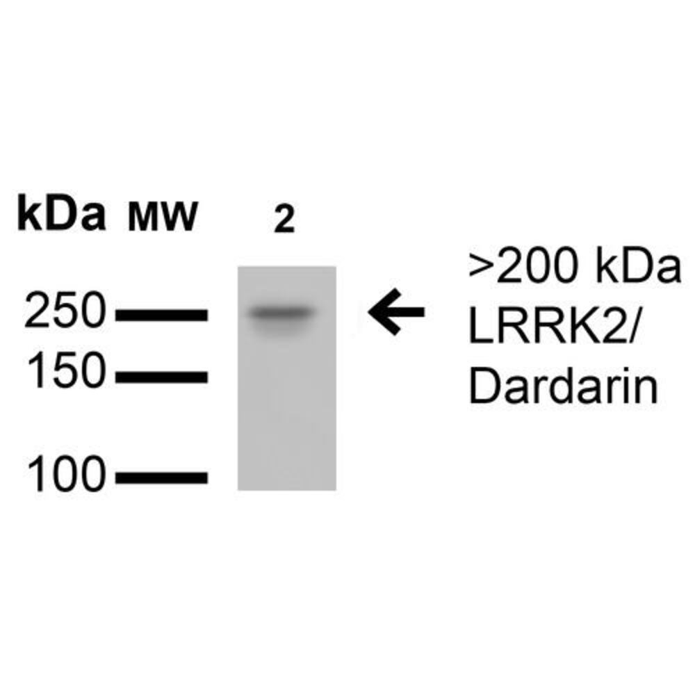 Anti-LRRK2 Antibody [S138-6]