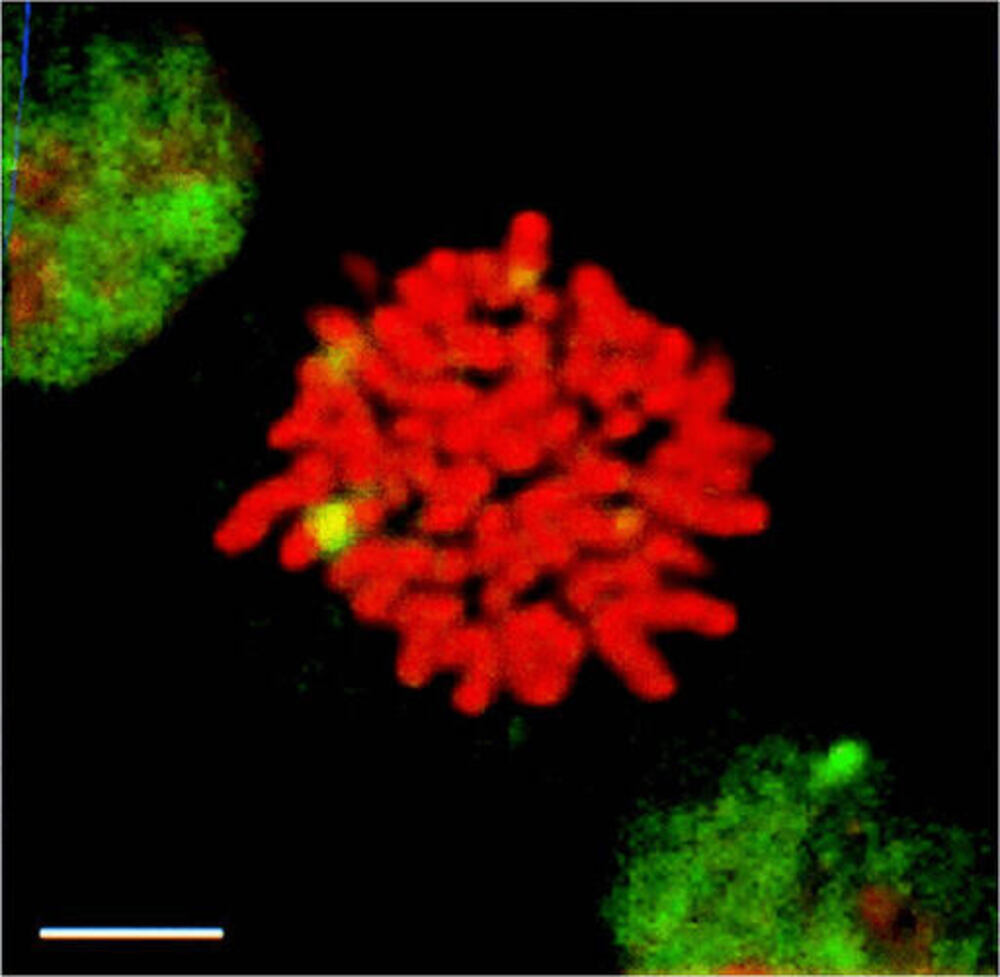 Anti-HSF1 Antibody [10H8]