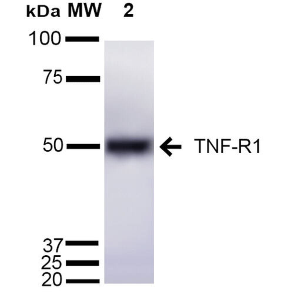 Anti-TNF Receptor I Antibody