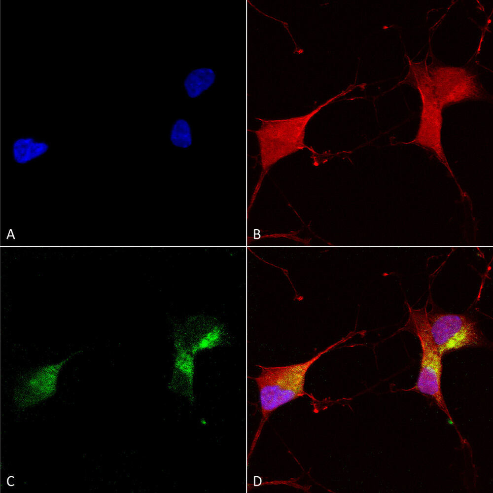 Anti-KCNQ1 Antibody [N37A/10], 100 µg