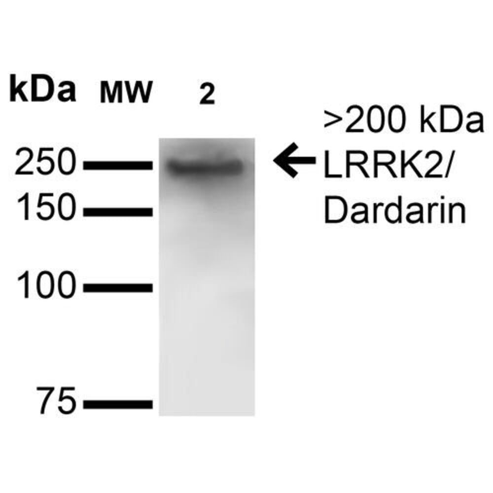 Anti-LRRK2 Antibody [S231B-34]