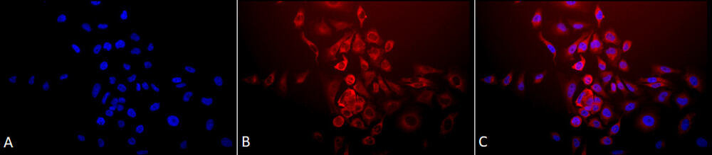 Anti-SOD2 / MnSOD Antibody