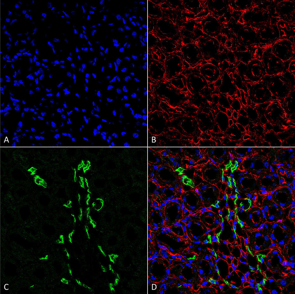 Anti-SLC14A2 Antibody