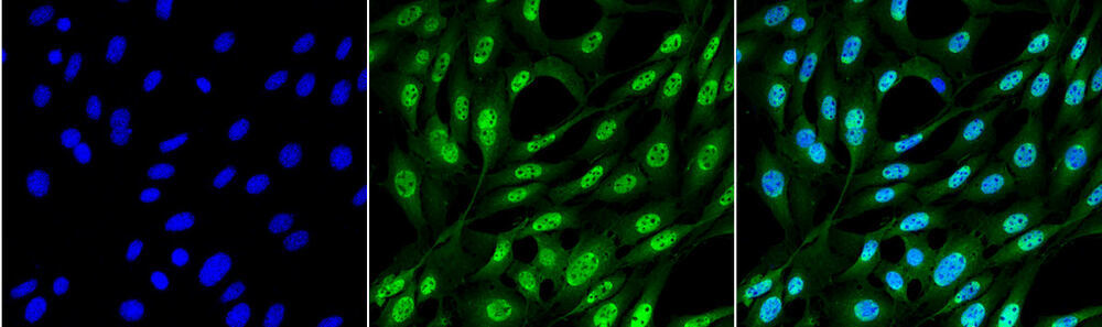 Anti-Ubiquitin Antibody [FK2]