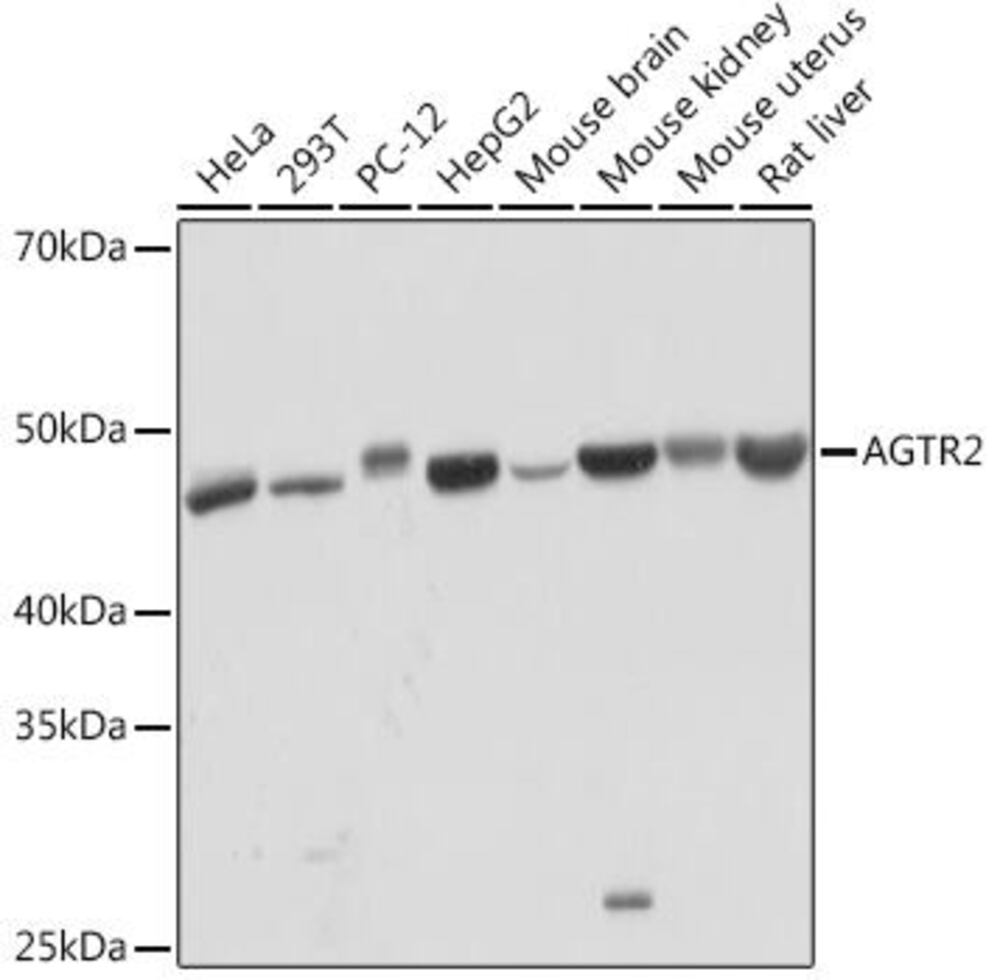 Anti-Angiotensin II Type 2 Receptor Antibody [ARC2064], 100 µl