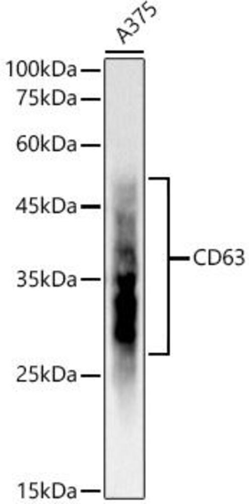 Anti-CD63 Antibody [ARC51703], 100 µl
