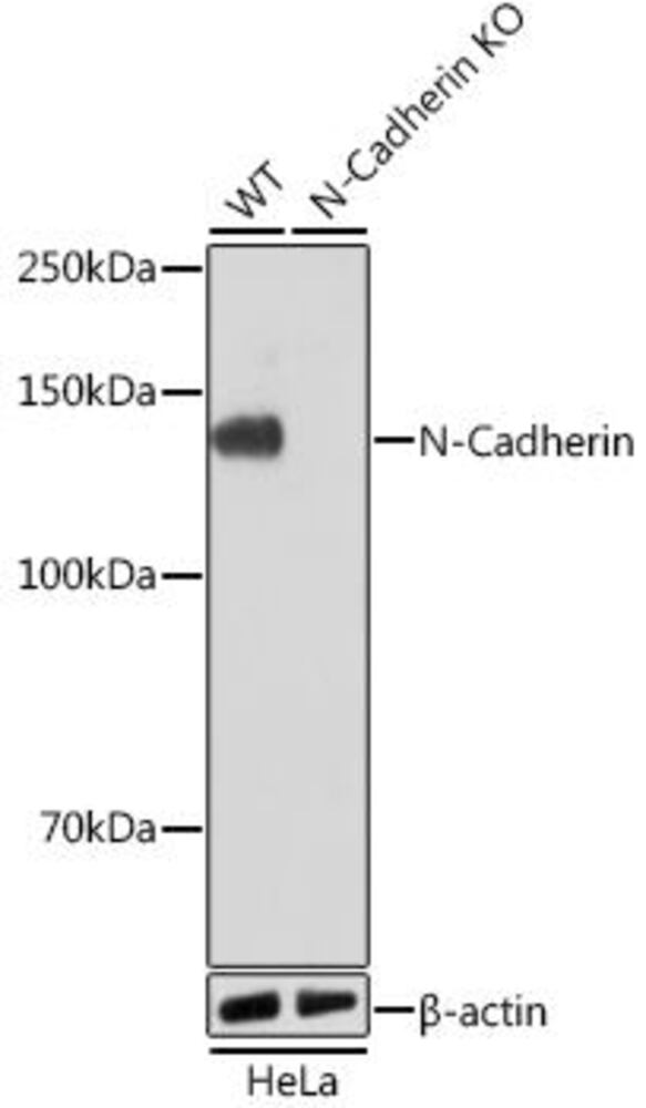 Anti-N Cadherin Antibody [ARC0371]