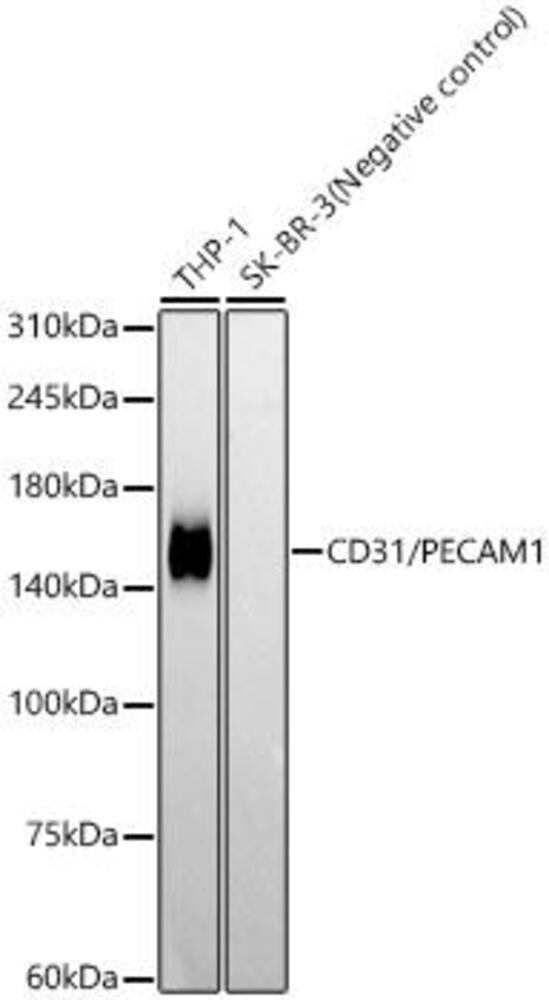 Anti-CD31 Antibody [ARC50362]