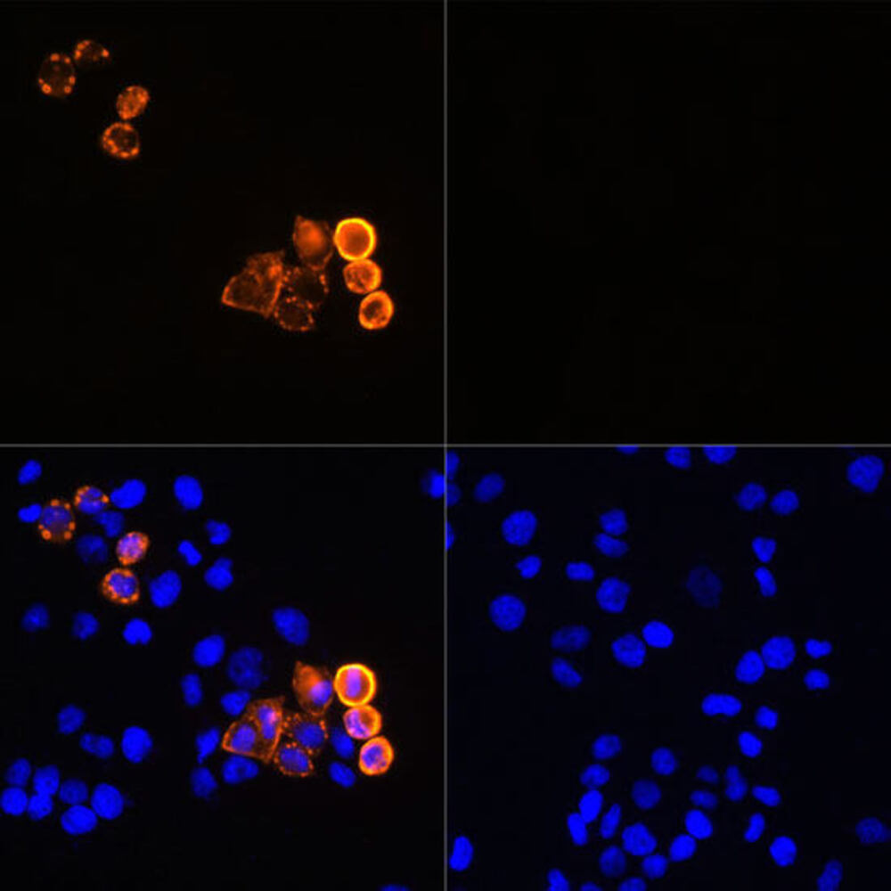 Anti-Myc Tag Antibody [ARC5004-12], 100 µl