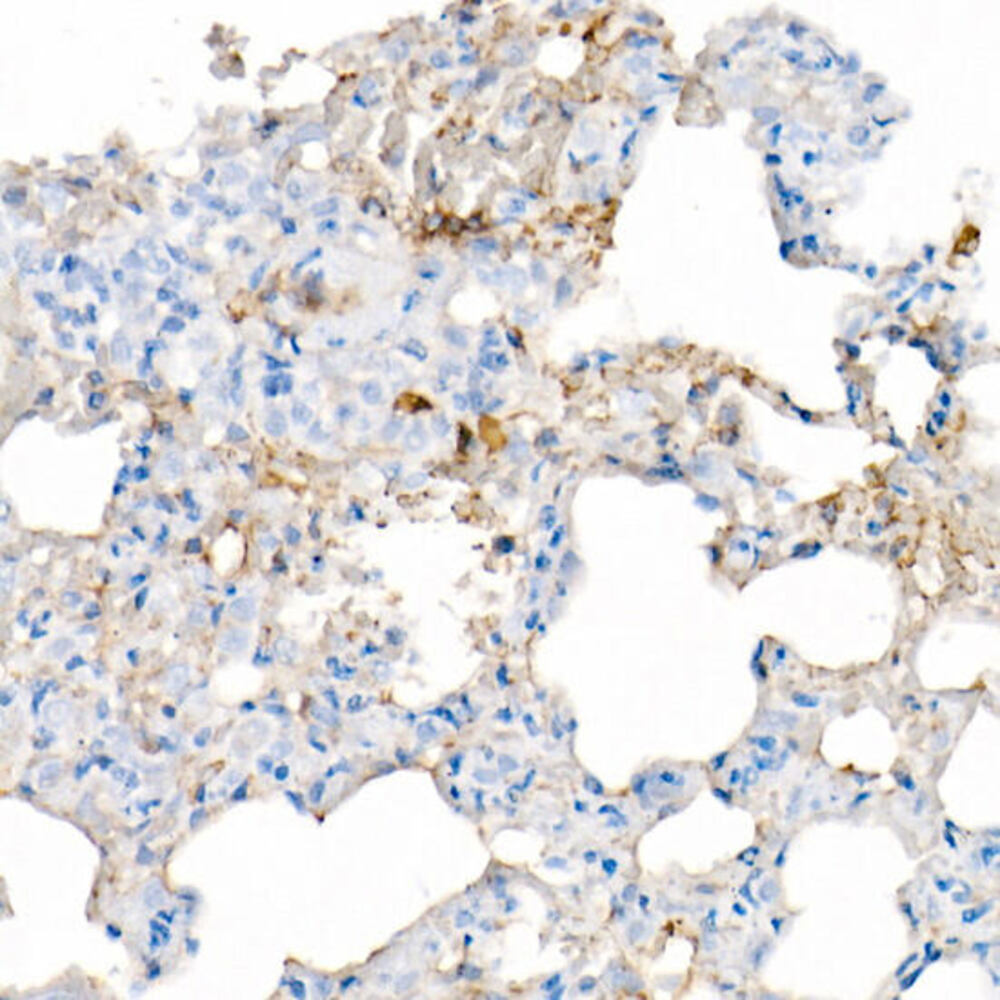 Anti-IL-6 Antibody [ARC53388]