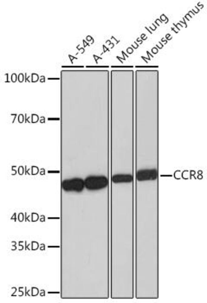 Anti-CCR8 Antibody [ARC0956]