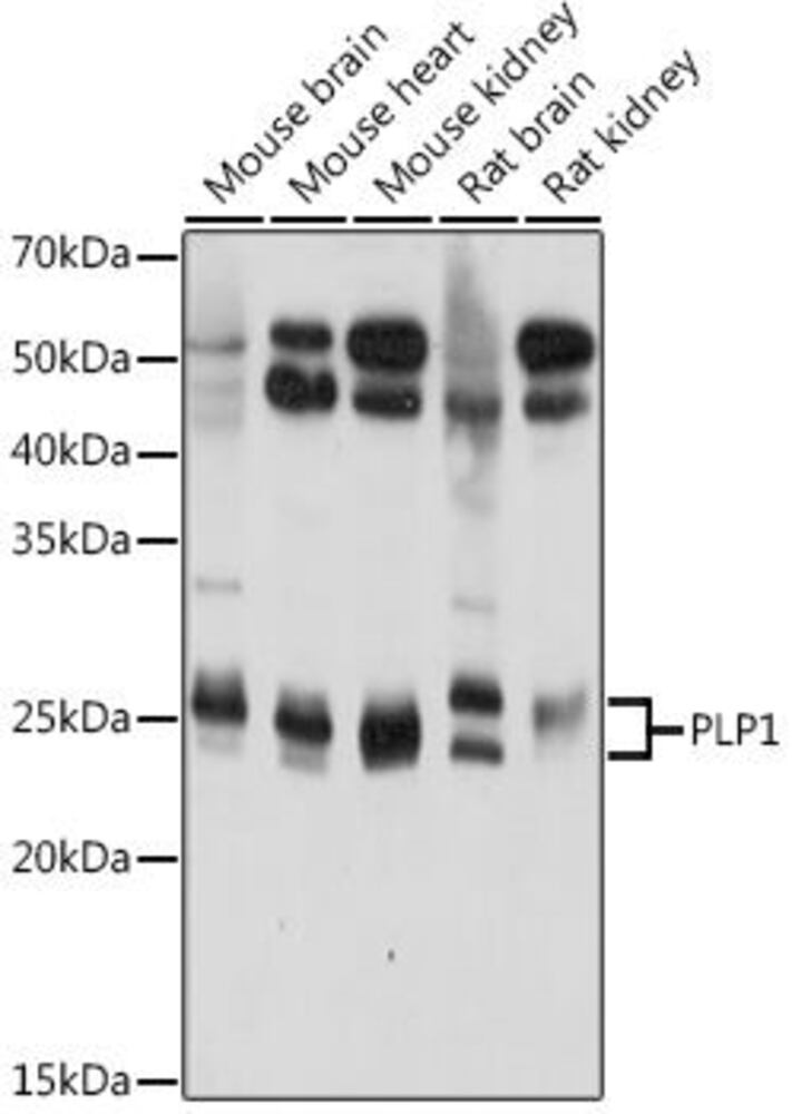 Anti-Myelin PLP Antibody