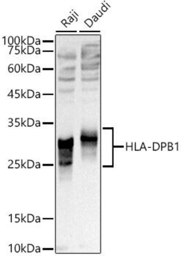 Anti-MHC Class II beta Antibody