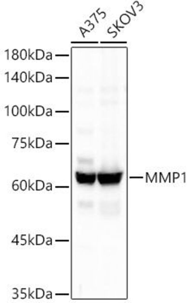Anti-MMP1 Antibody [ARC55239]