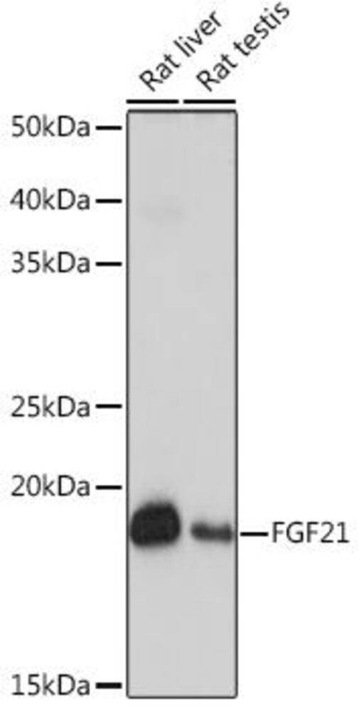 Anti-FGF21 Antibody [ARC53983]