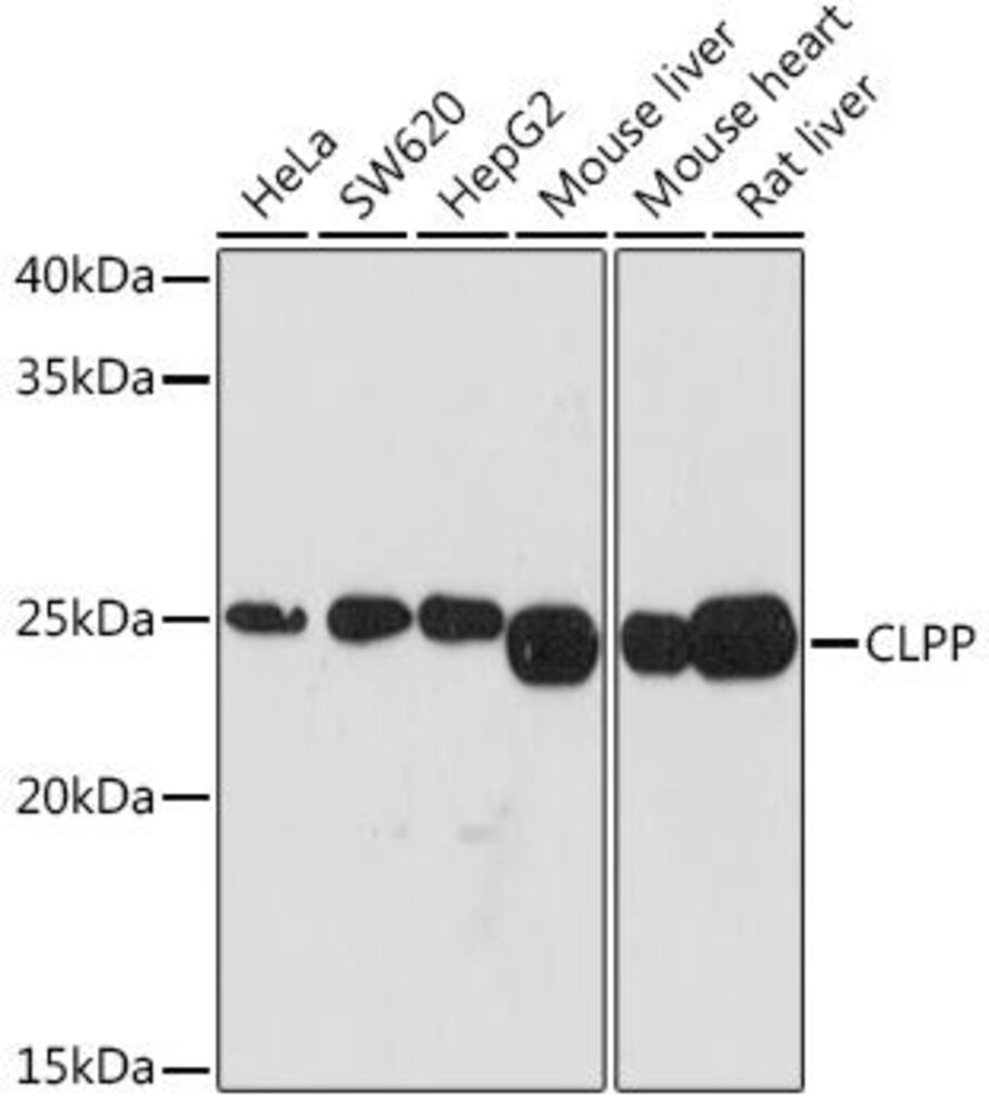 Anti-CLPP Antibody [ARC1929]
