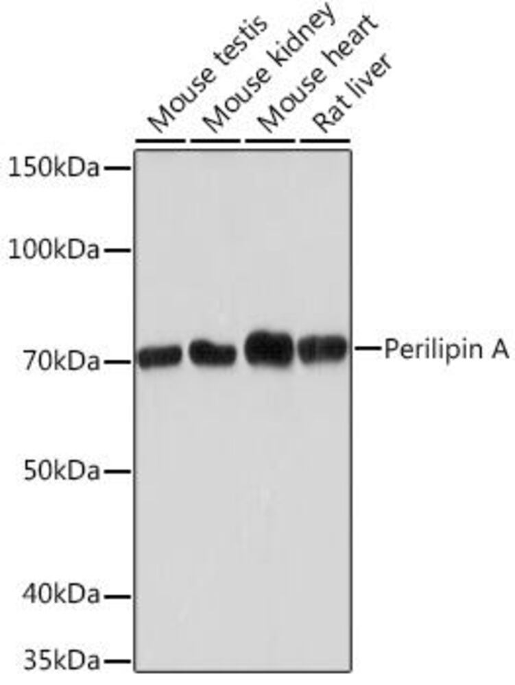 Anti-Perilipin-1 Antibody [ARC1122]