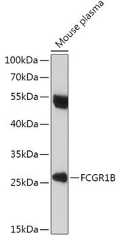 Anti-CD64 Antibody