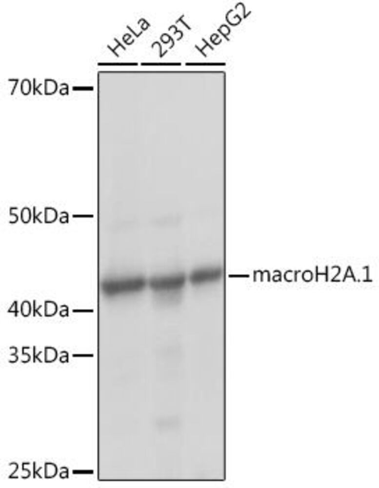 Anti-mH2A1 Antibody [ARC1396], 100 µl