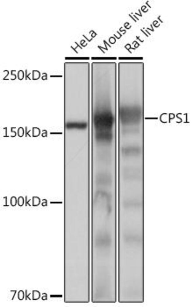 Anti-CPS1 Antibody [ARC0929], 100 µl