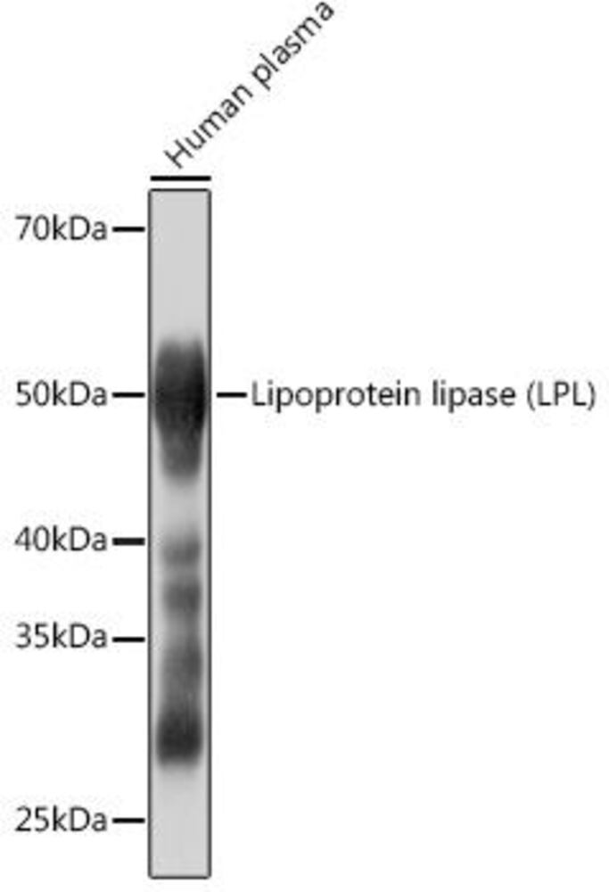 Anti-Lipoprotein lipase Antibody [ARC090, 4], 100 µl