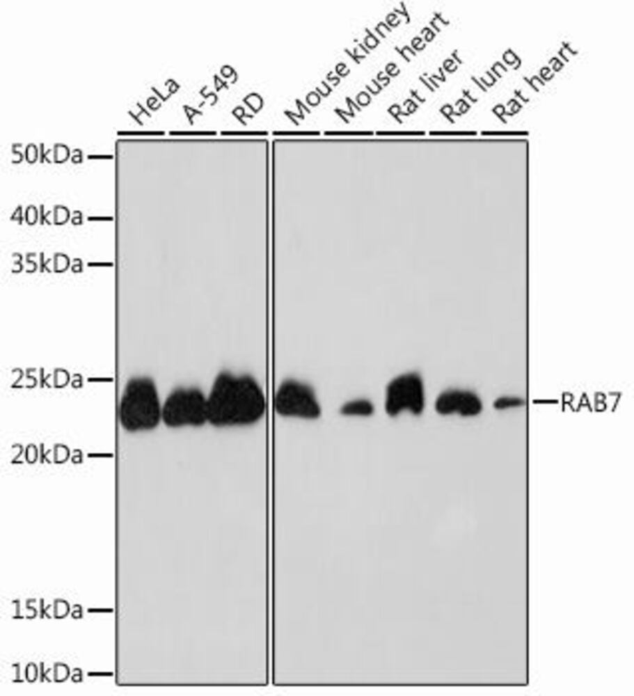 Anti-RAB7 Antibody [ARC0314]