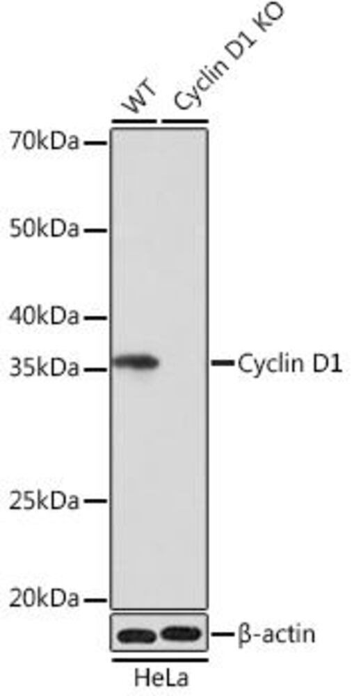 Anti-Cyclin D1 Antibody [ARC0300]