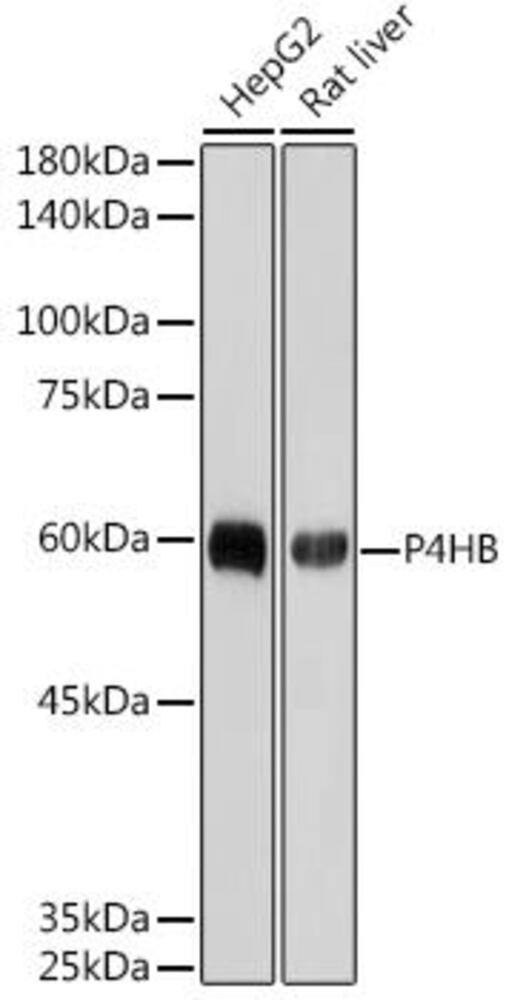 Anti-P4HB Antibody [ARC2398]