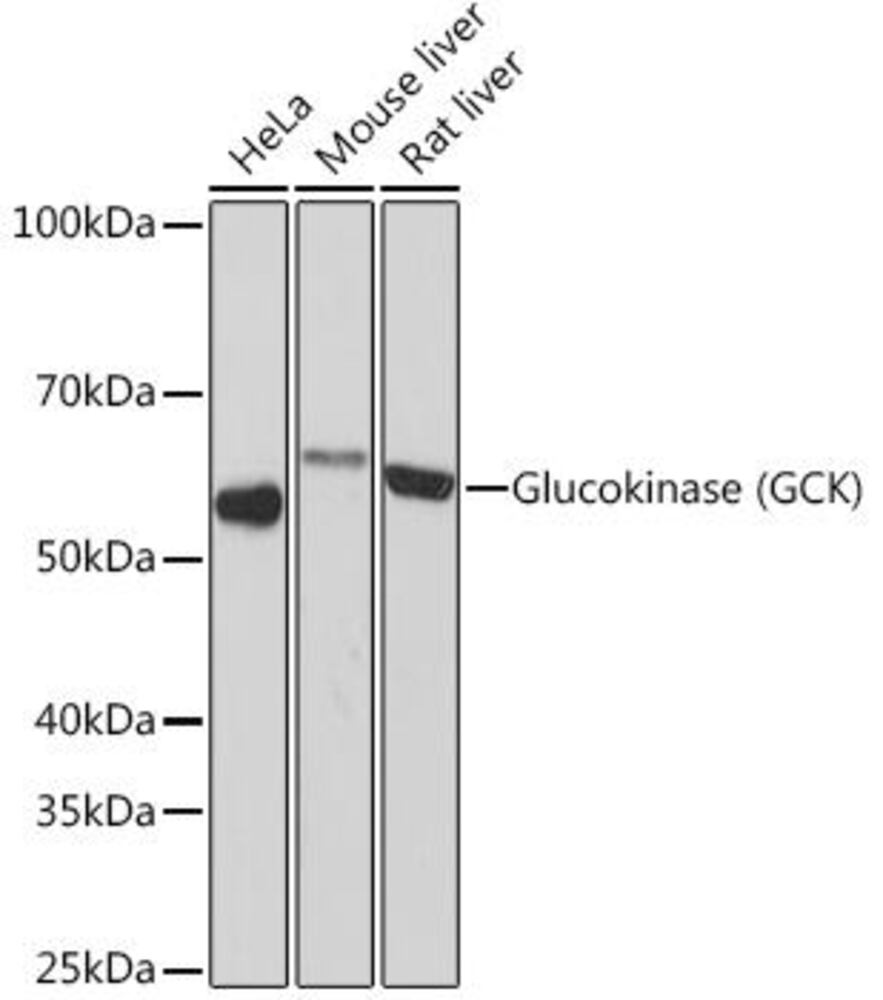 Anti-Glucokinase Antibody [ARC1226]