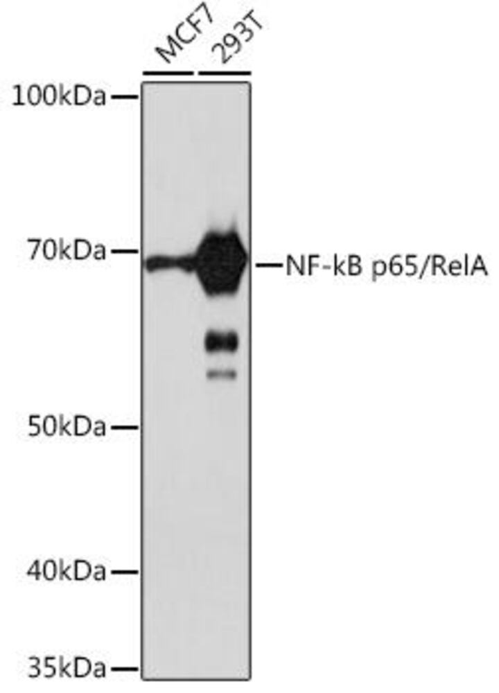 Anti-NF-kB p65 Antibody [ARC51086]