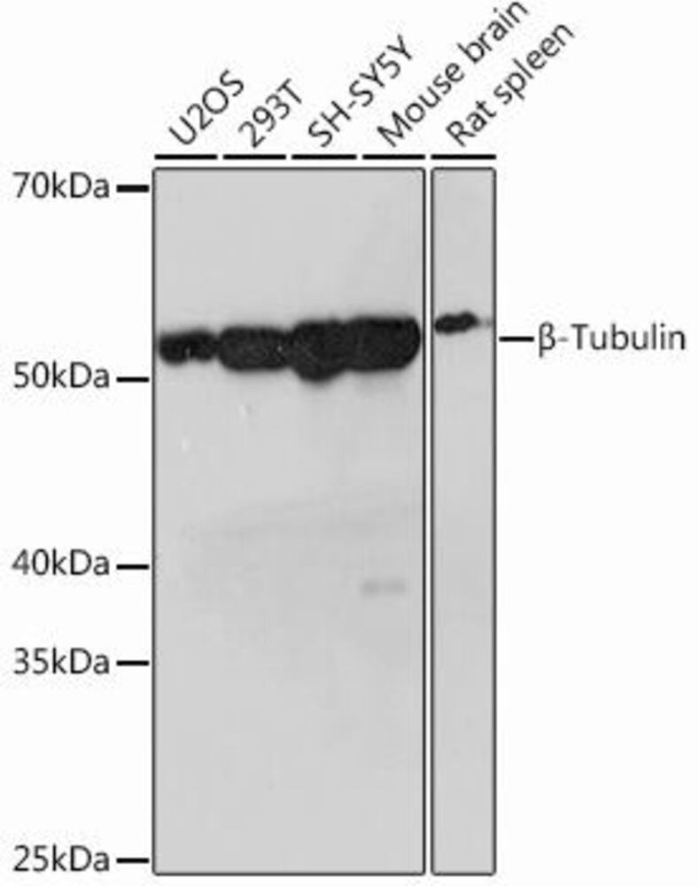 Anti-beta Tubulin Antibody [ARC0203]