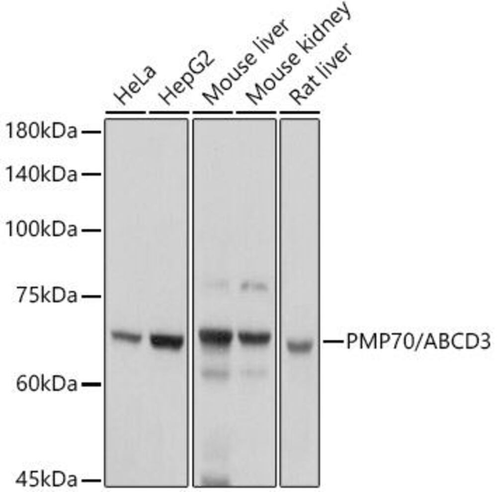 Anti-PMP70 Antibody, 100 µl