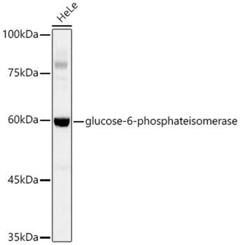 Anti-glucose-6-phosphate isomerase antibody [ARC0997], 100 µl