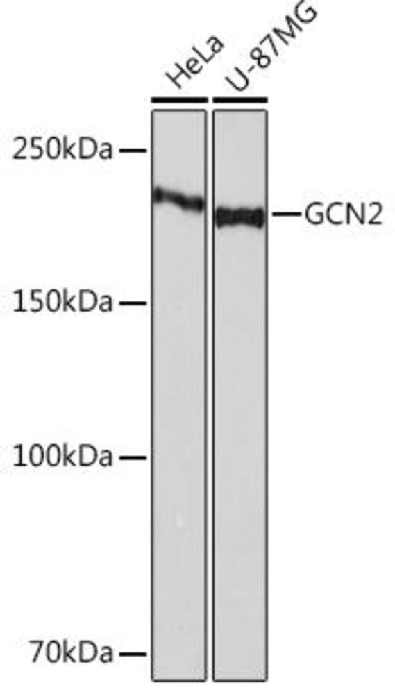 Anti-GCN2 Antibody [ARC52336]
