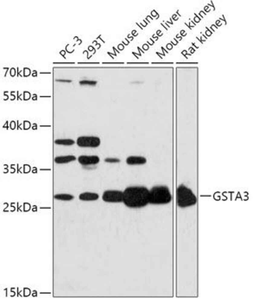 Anti-GSTA3 Antibody