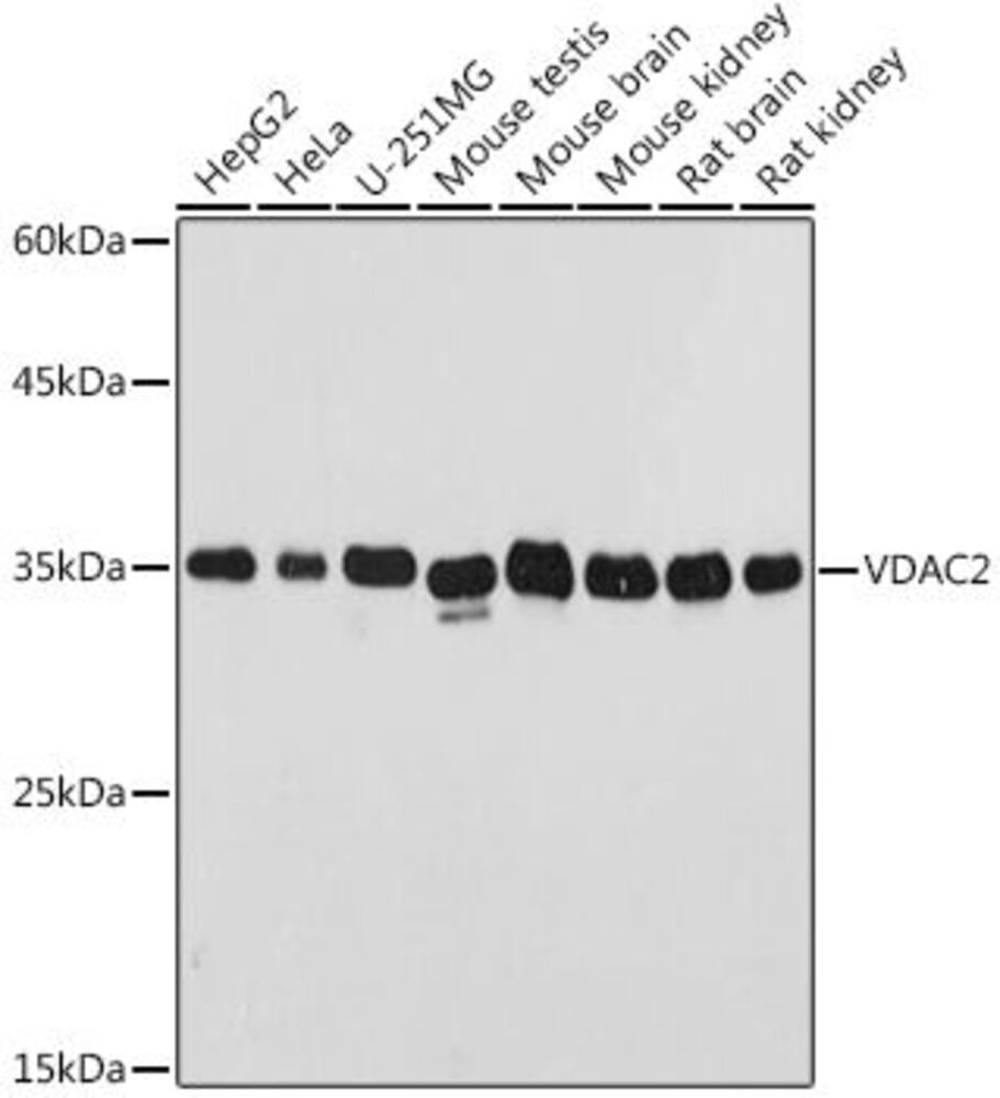 Anti-VDAC2 Antibody, 100 µl