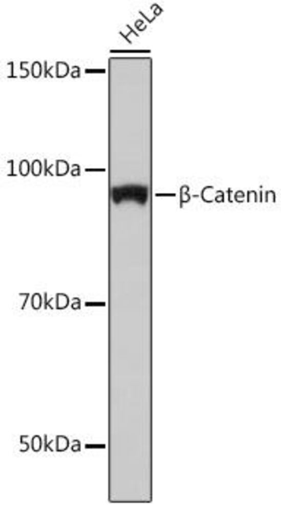 Anti-beta Catenin Antibody [ARC0136], 100 µl