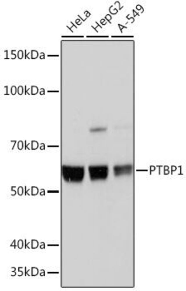 Anti-PTBP1 Antibody [ARC0783]